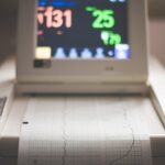 Detailed image of an electronic fetal monitoring machine showing heart rate and contraction data.