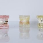 Three dental models, including one with braces, illustrate orthodontic and oral care relevant to water flosser effectiveness.