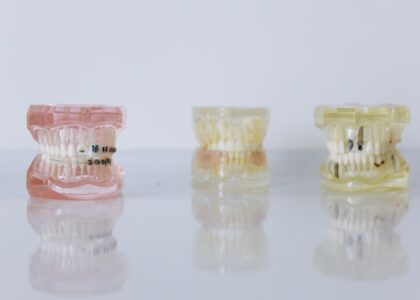 Three dental models, including one with braces, illustrate orthodontic and oral care relevant to water flosser effectiveness.