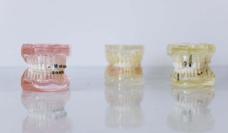 Three dental models, including one with braces, illustrate orthodontic and oral care relevant to water flosser effectiveness.
