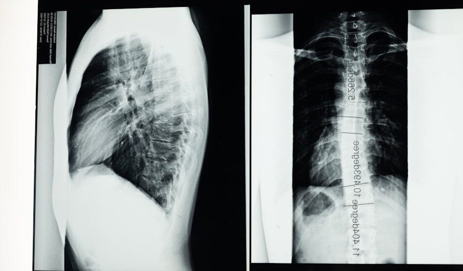 High-resolution X-ray showing a detailed examination of human spine with scoliosis.