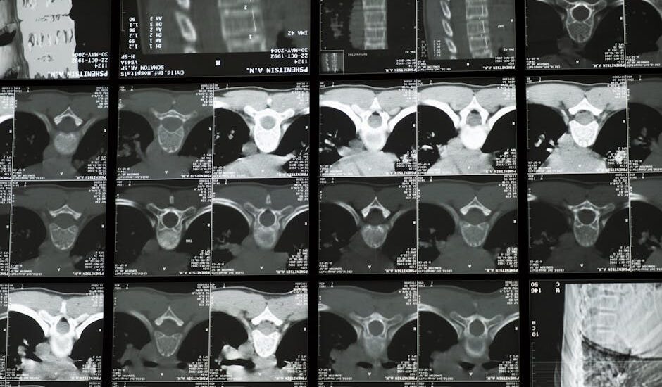 Multiple spinal x-ray and CT scan images displayed together, illustrating the medical evaluation process for scoliosis back braces