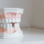 Dental model with string floss threaded between teeth, illustrating the comparison of water flossers and string floss for oral care