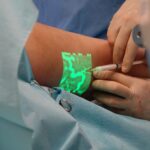 A healthcare professional using a vein finder on a patient's arm, illustrating home vein finder technology.