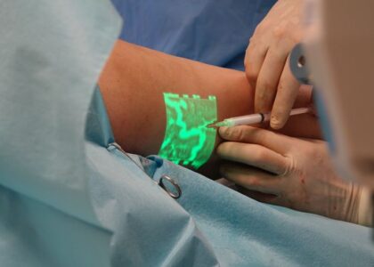 A healthcare professional using a vein finder on a patient's arm, illustrating home vein finder technology.