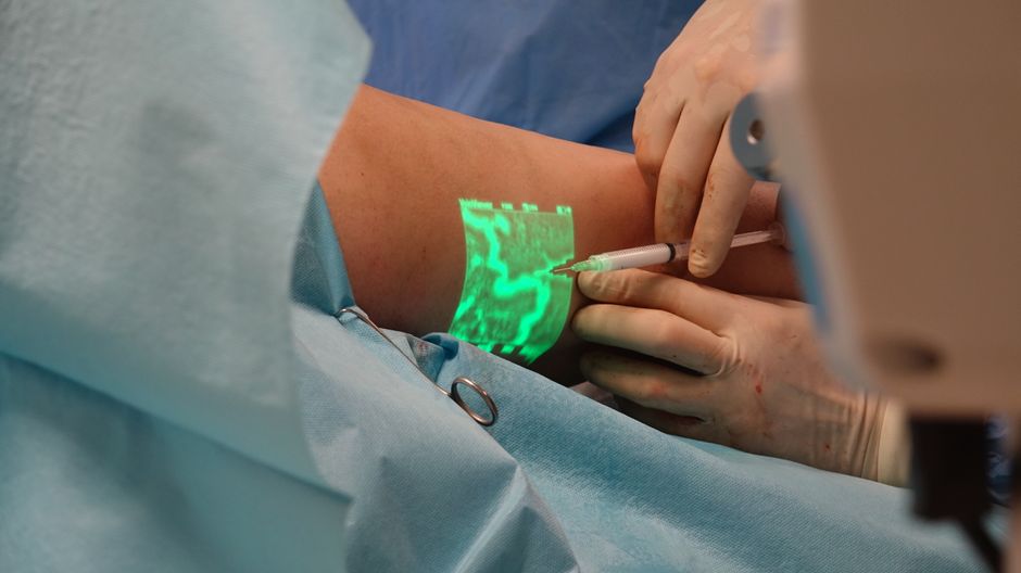 A healthcare professional using a vein finder on a patient's arm, illustrating home vein finder technology.